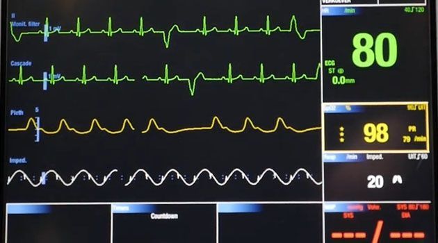 ❤ AI can relieve cardiac specialists by automatically analyzing ECG