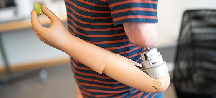 💪 Arm prosthesis that gives the feeling back