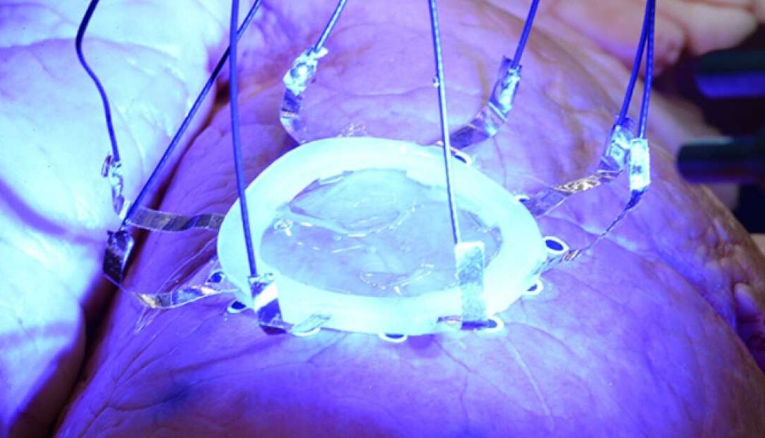 🩹 3D printing directly on organs revolutionizes medical treatment and control