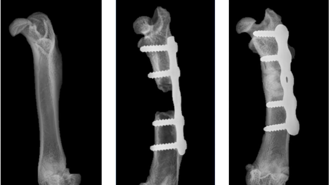 🚑 Artificial bone heals severe bone fractures