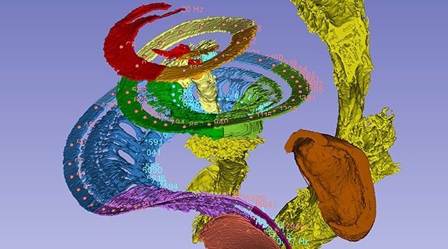 👂 3D map for the inner ear can provide better treatment of hearing damage