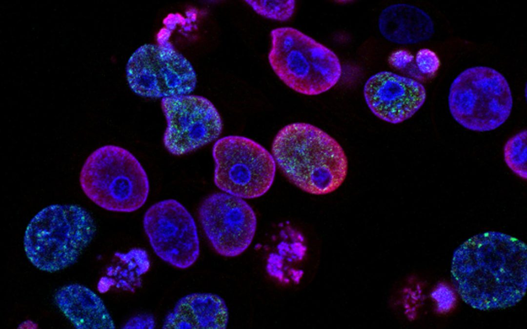 👃 An electronic nose smells cancer in blood samples