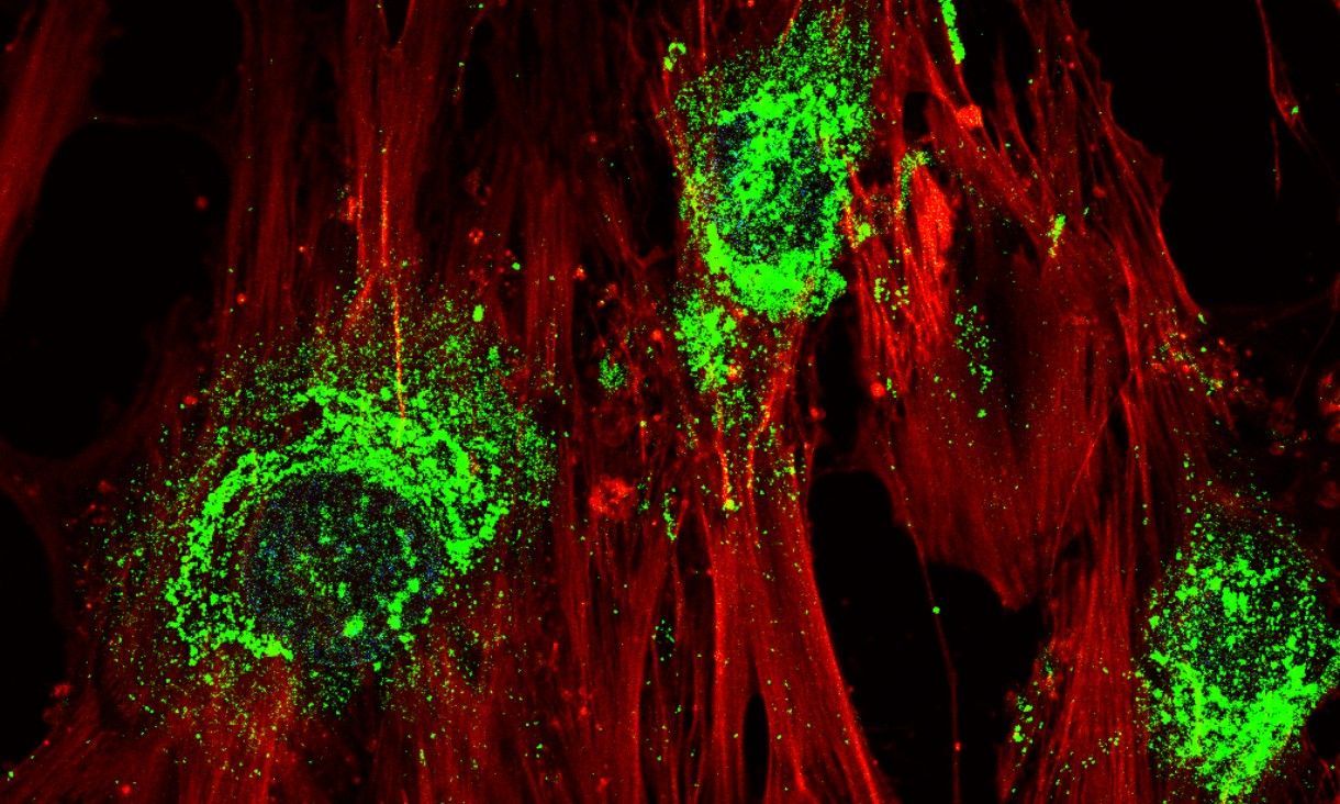 🦿 Sound waves can help bone fractures heal faster