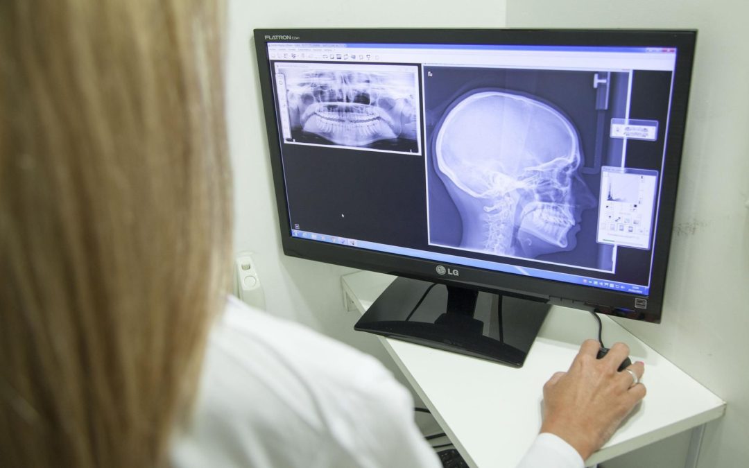 👩‍⚕️ EU approves automatic AI analysis of X-ray images