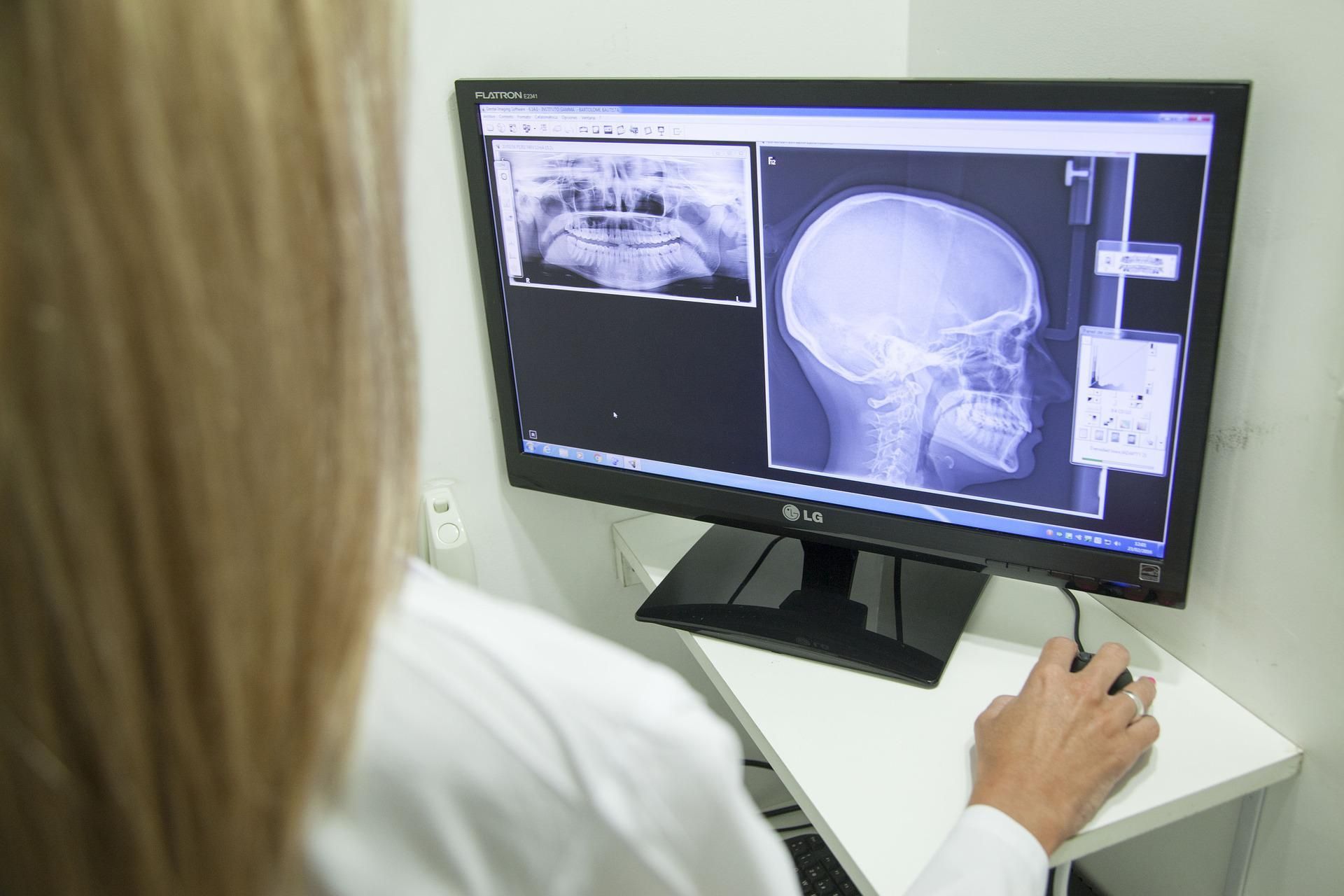 👩‍⚕️ EU approves automatic AI analysis of X-ray images